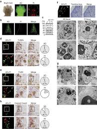 Xiang fu zi is a traditional chinese medicinal herb to regulate the qi, sooth the liver, ease pain and regulate menstrual blood flow. Vital Staining For Cell Death Identifies Atg9a Dependent Necrosis In Developmental Bone Formation In Mouse Nature Communications