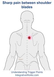 Inflammatory disorders such as pericarditis, pancreatitis, and pleuritis cause referred pain. Pin On Back Pain Neck Pain