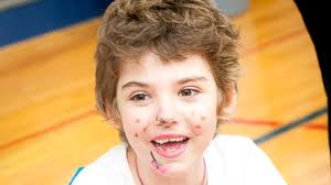 Procedură surprinzătoare: O fetiţă de şapte ani, bolnavă de cancer, a fost  vindecată cu ajutorul HIV