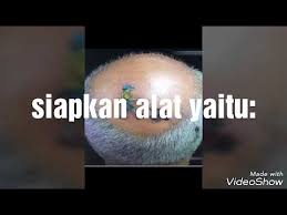 Cara Menghilangkan Sablon Baju Youtube Cara menghilangkan bruntusan yang pertama adalah dengan melakukan deep cleansing pada wajah anda. cara menghilangkan sablon baju youtube