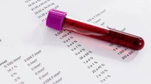 Zur verrechnung mit ihrer krankenkasse muss dies von ihrem zuweisenden arzt auf der überweisung vermerkt werden. Blutbild Wer Zahlt Privat Oder Krankenkasse Happy Blood