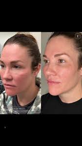 Thank you @your.master.aesthetician for my Gua sha stone! I always forget  what a difference these tools make. Here you will see me using it with my  serums first and then also over