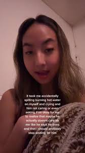 The Time I Accidentally Boiling Hot Water