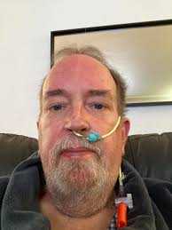 Why does my adult daughter's feeding tube keep popping out?