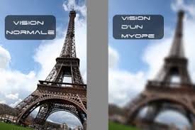 Centre de la vision martigues. Chateauneuf Vision