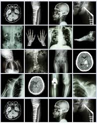X Rays Art Ceramic Decals Enamel Decal Fusible Decal Glass Fusing Decal Waterslide Decal 49364 In 2020 Xray Art Glass Decals X Ray