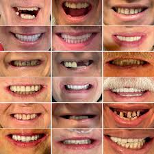 Dentist Fort Worth & Amarillo