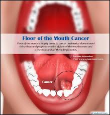 Pin Di Face Mouth And Throat Pain