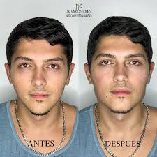 ATTENTION! We have some changes: MAIN HEADQUARTERS 📍ORLANDO and we will be  there twice a month 📍MIAMI schedule your appointment to DM or by whatsapp