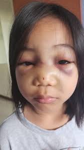 7-year-old S'pore girl allegedly flung off seat