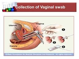 O charcoal media swabs x2 (high vaginal and endocervical) o white chlamydia swab pack (endocervical) · wash tray and place equipment inside in partially open packets. Mrs Dalia Kamal Eldien Msc In Microbiology Ppt Video Online Download