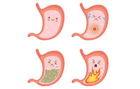 Image result for Pediatric Reflux