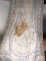Blut Oder Brauner Ausfluss Forum Schwangerschaft Urbia De