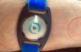 Image result for Sweat Chloride