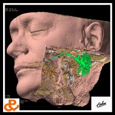 Dr. Omar L. Cohen Rojas (@cohencirugiamaxilofacial) • Instagram photos and  videos