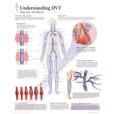 understanding dvt deep vein thrombosis chart