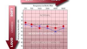 how to read an audiogram