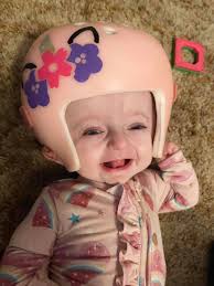 Remember everyone her head did not grow bigger over the spring