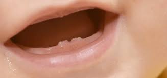 So individuell, wie wir menschen sind, ist auch der zeitpunkt, zu dem wir unsere ersten zähne bekommen. Gesunde Zahne Oje Ich Wachse