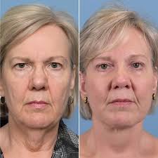 Hamilton Facial Plastic...