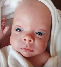 Family keep tiny baby Finlay Mackenzie safe at home after miracle birth