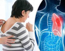 Weight changes, including unintended loss or gain. Lung Cancer Symptoms Causes Treatment Of This Life Threatening Disease Health News India Tv