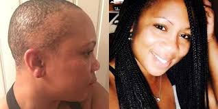 Want more body in your hair? This Woman Turned Traction Alopecia Into A Lesson In Self Care