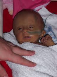 David Smith is fundraising for ROSY Fund (part of the Oxford Health Charity)