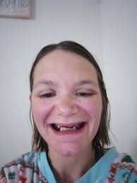 Home in the Bay Area and Mercedes in the driveway!! Did it without my drug  addicted husband! Now ex husband!