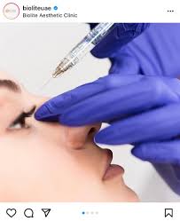 We did not find results for: 3 Things You Should Know Before Getting A Nose Job