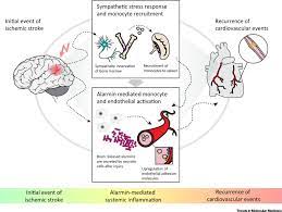 Stroke Promotes Systemic Endothelial Inflammation And Atherosclerosis Trends In Molecular Medicine