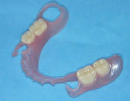 The biggest factor that affects the cost of an extraction is how your wisdom tooth emerged. Clinical Application Of Removable Partial Dentures Using Thermoplastic Resin Part I Definition And Indication Of Non Metal Clasp Dentures Sciencedirect
