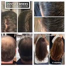 Pin By Holly Johnson On Neora Before Afters Ciara Hair Hair System Long Bob Hairstyles