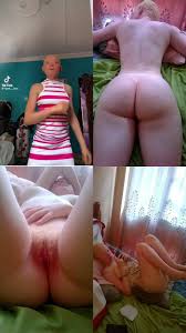 Albino Girl Nude Pictures Leaked Online - Naijapornsite
