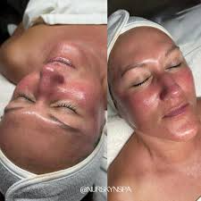 Free facial with purchase at dermatologist office