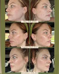 Gypsy Gem Esthetics by Meg (@gypsy_gem_meg) • Instagram profile