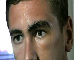 Steve Davies: How skull injury almost ended my career