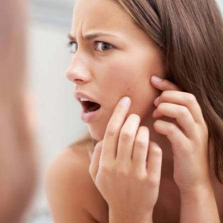 Pimple Patches tegen puistjes