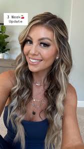 3 week 🍒 post op!