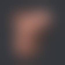 Erection small