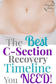 C Section Recovery Timeline Forgotten Lattes C Section Recovery Timeline C Section Recovery C Section