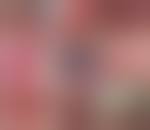 Image result for Erythroplakia roof of mouth