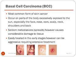 The ultraviolet light in sunlight damages the dna in the skin cells. Skin Cancer Prevention May Background Information Part One Ppt Download