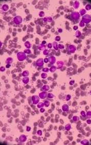 Causes for mucus in urine. Ada Apa Di Stasiun Ce Inseamna Rare Celule Epiteliale Plate Showing 1 1 Of 1