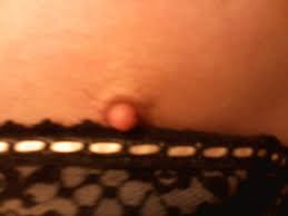 Tiny Nipple | rkallerud | Flickr