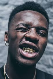 Gold teeth / gold crowns. Can You Remove Your Gold Teeth