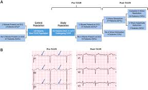 Image result for U Wave