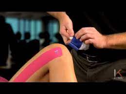 Die komplette anleitung zum tapen eines läuferknie itbs hip the it band, or iliotibial band, is a thick band of fibrous tissue that runs down the outside of the leg. Kt Tape Itbs At Knee Youtube