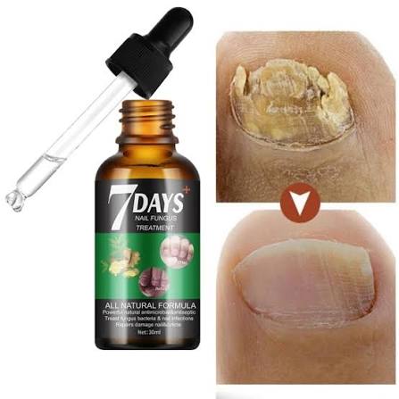 Sérum Para Tratamiento De Hongos En Las Uñas En 7 Días Repara Uñas Y Cutículas Dañadas 30ml Mooyam - Buy Product on Alibaba.com