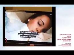 Kleine Levin Syndrome Jody S Story Youtube